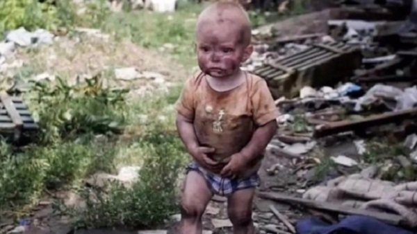 Reality : इस बच्चे के फोटो ने लोगों के कलेजे को चीरा, क्या है सच्चाई?