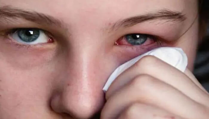 Eye care tips आंख में धूल या कीड़ा गिरने पर करें ये काम, मिलेगा जल्द आराम