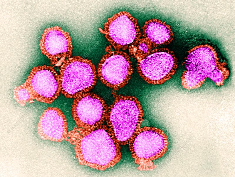 H3N2 virus: स्वाइन फ्लू H3N2 वायरस की दस्तक, रूस में मिला पहला केस