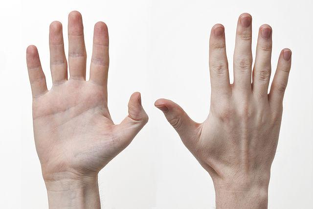 Health Update : हाथों के ज़रिये पता करिये सेहत का हाल ! ये लक्षण हो सकते हैं बड़ी बीमारी का संकेत