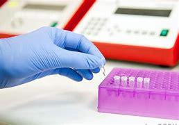 RT-PCR test