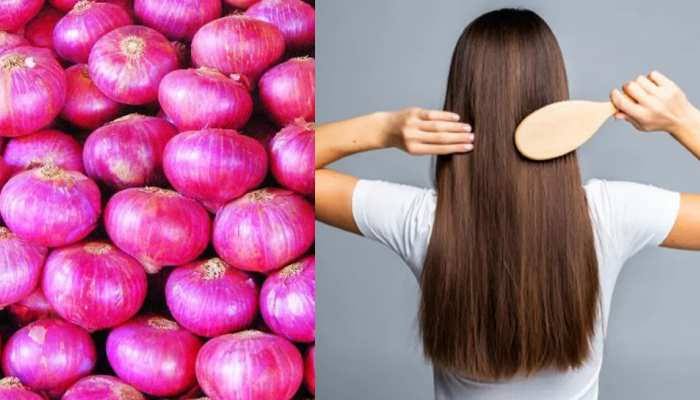 Home Remedies of Dandruff: Get rid of dandruff with these remedies with onion juice