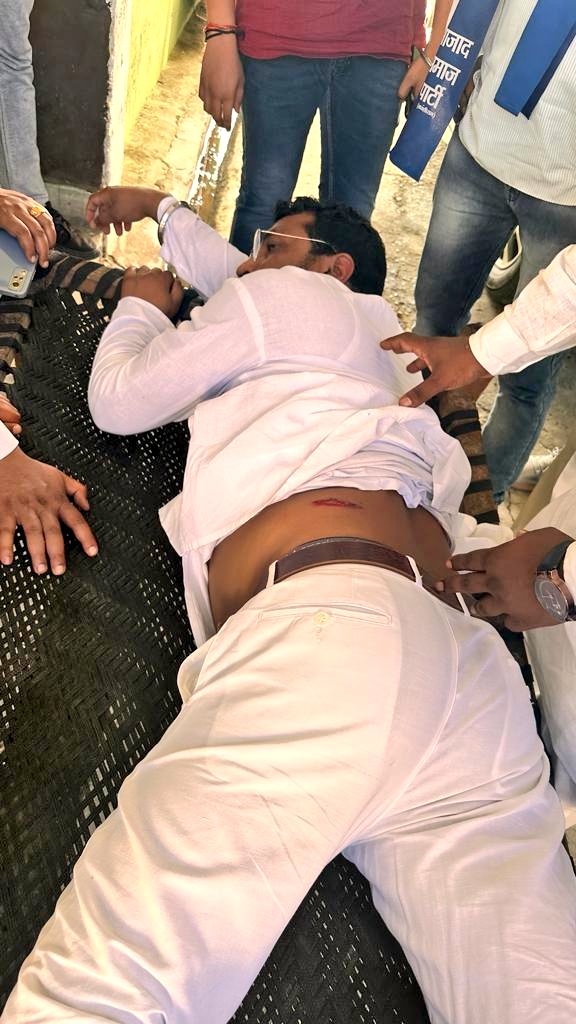 Saharanpur: भीम आर्मी प्रमुख चंद्रशेखर रावण पर जानलेवा हमला, पेट से छूकर निकली गोली