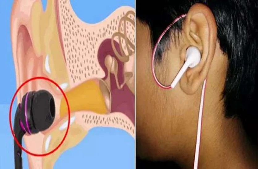 Health Update: Don't let earphones deafen you