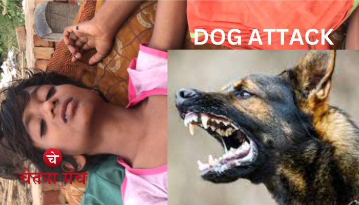 Dog Attack Kid: आवारा किस्म के खूंखार कुत्तों ने नाबालिग मासूम को नोंचकर किया लहूलुहान