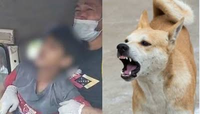 Bulandshahr Dog Bite:गाज़ियाबाद में कुत्ते के काटने से मरने वाले बच्चे के परिवार के 16 सदस्यों ने लगाया एआरवी टीका